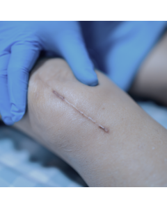 Aspectos nutricionais relacionados a Cicatrização