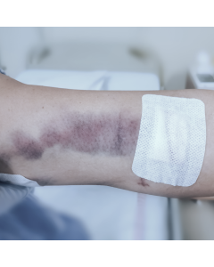 Assistência de Enfermagem nas Lesões Traumáticas e Queimaduras