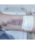 Assistência de Enfermagem nas Lesões Traumáticas e Queimaduras