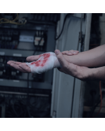 Fundamentos para avaliação da Pele e Feridas