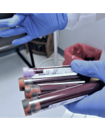 Interpretação de Exames Laboratoriais