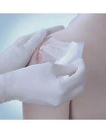 Habilitação em Tratamento de Feridas